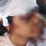 বদলগাছীতে ঘরে ঢুকে গৃহবধূকে কুপিয়ে জখম, জনমনে আতঙ্ক